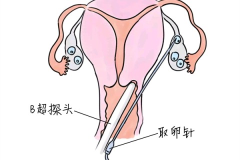 http://shenyang.vdtfzz.com/post/205.html|沈阳供卵助孕